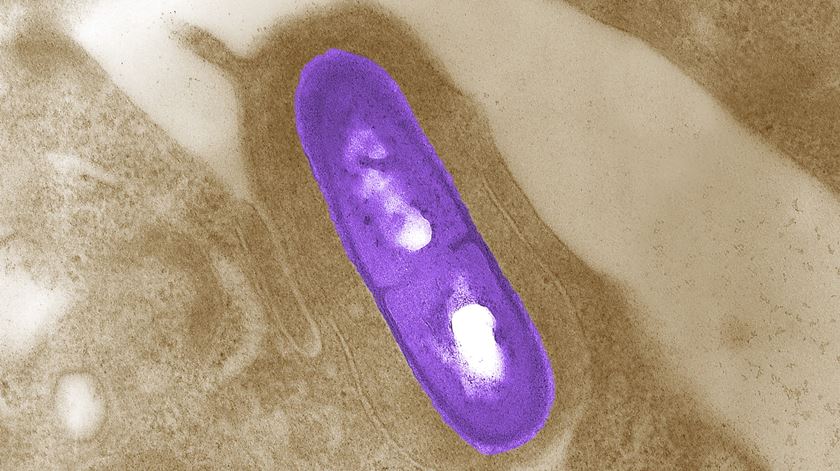 Listeria monocytogenes Foto: Reuters