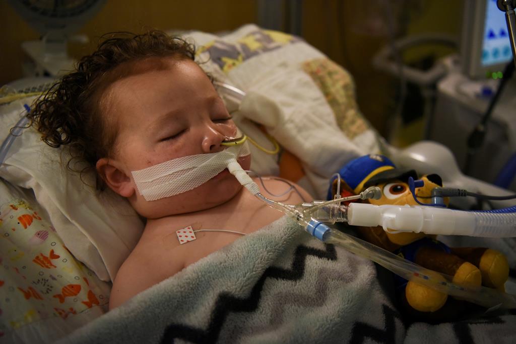 Criança de dois anos respira com ajuda de um ventilador, num hospital em Missouri, nos EUA, depois de testar positivo com o novo coronavírus em outubro deste ano. Foto: Callaghan O