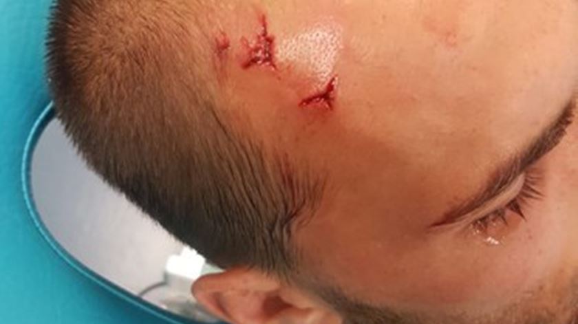 Golpe na cabeça de Dost, após ter sido agredido com um cinto. Foto: DR