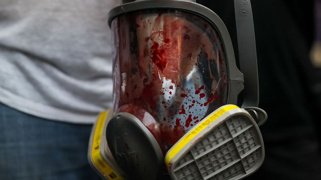 Máscara de gás do jornalista Gregory Jaimes, depois de ser ferido durante as manifestações de Caracas, no dia 1 de maio. Fotografia: Miguel Gutierrez/EPA