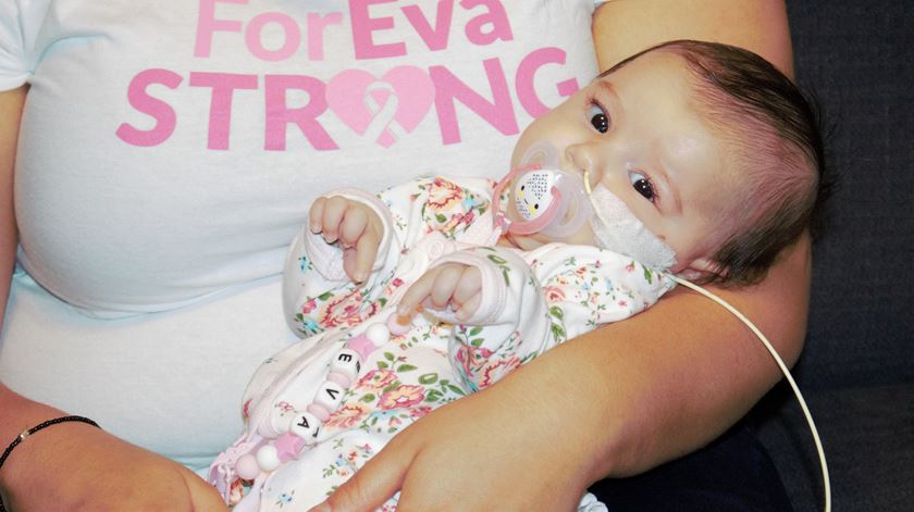 A bebé Eva nasceu a 11 de agosto e foi diagnosticada com a doença às sete semanas de vida. Foto: Sérgio Mourato/Lusa