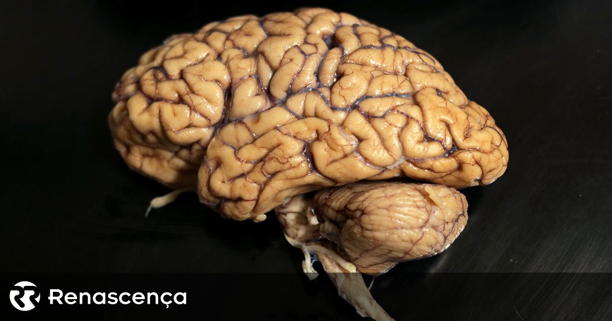 Alzheimer. Empresa portuguesa recebe 1,5 milhões de euros para investigar tratamento para doença