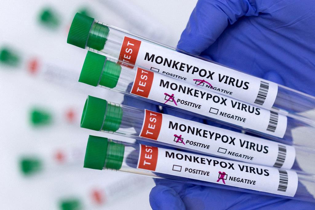 varíola dos macacos, monkeypox Foto: Reuters