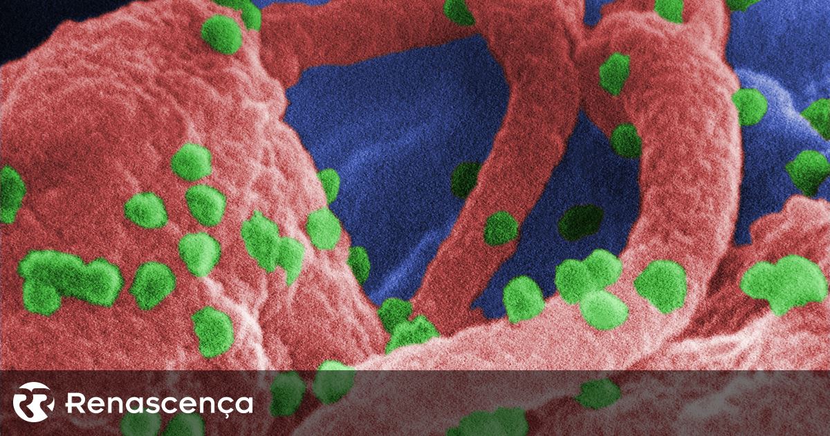 Alemão ficou curado de infeção VIH/sida após transplante de dador não imune