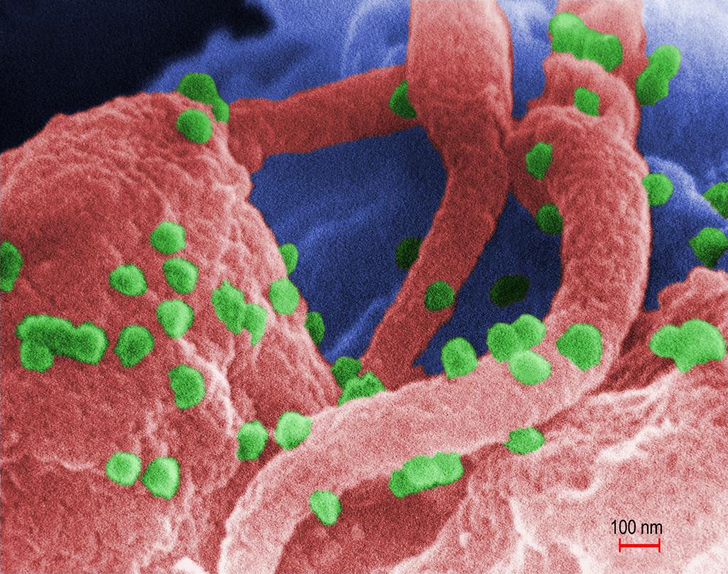A verde os viriões de VIH, numa imagem microscópica de um linfócito infetado. Foto: CDC