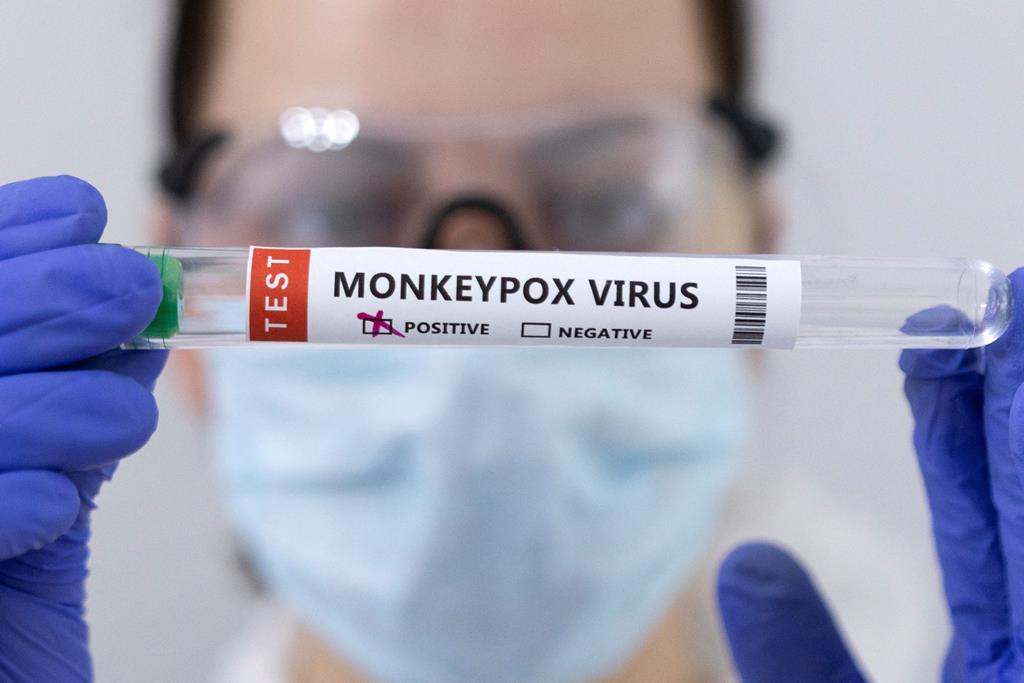 Infarmed dá autorização excecional a vacina da monkeypox. Foto: Reuters