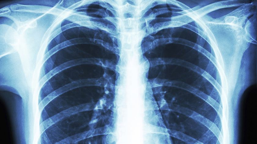 As mortes por pneumonia afetam sobretudo os mais velhos. Foto: DR