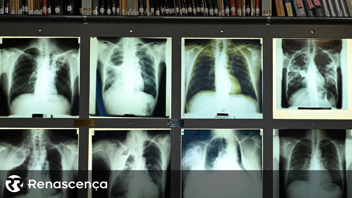 Exames convencionados de radiologia custaram mais de 100 milhões de euros ao SNS