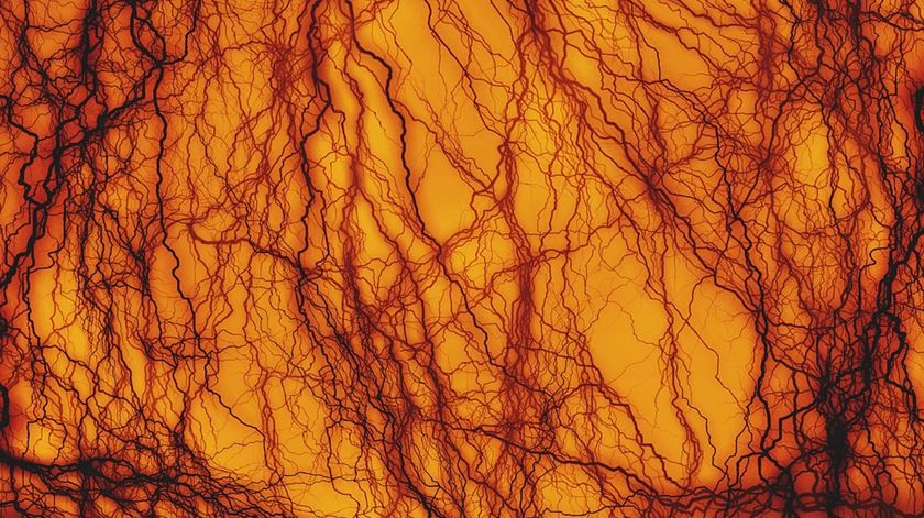 Matéria prima é biotinta obtida a partir de células da artéria aorta e de uma veia umbilical. Foto: Pixabay